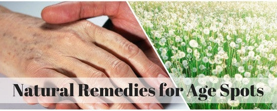 Easy Home Remedies for Age Spot Removal